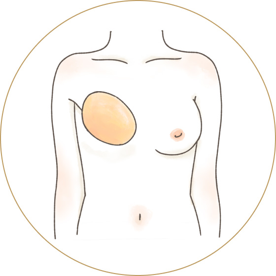 乳がんパッド/人工乳房】ブレストケアヌーブラ・ウォータードロップ3